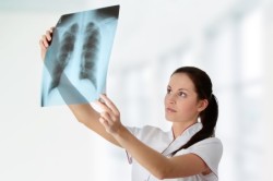 Рентгенологическое исследование легких при бронхите